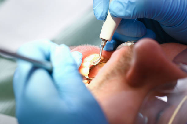 Best Same-Day Emergency Dental Services in Clisle, AR