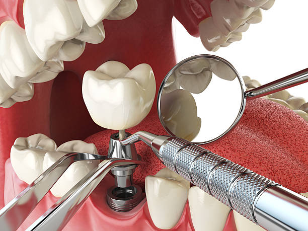 Best Cosmetic Emergency Dentistry in Clisle, AR